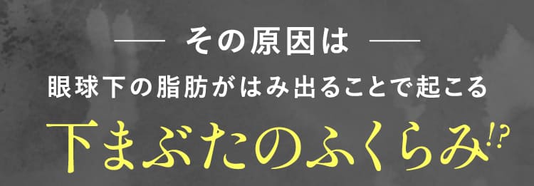 その原因は、眼球下の脂肪がはみ出ることで起こる、下まぶたのふくらみ!?